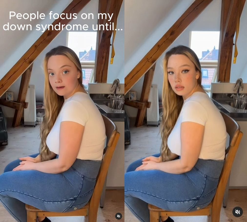 People Are Using AI to Create Influencers With Down Syndrome Who Sell Nudes
